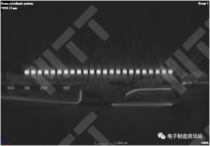 CT 斷層掃描結(jié)果